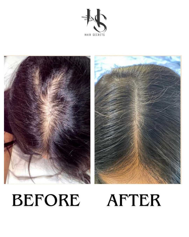 Rosemary Hibiscus Hair Oil (50ml)